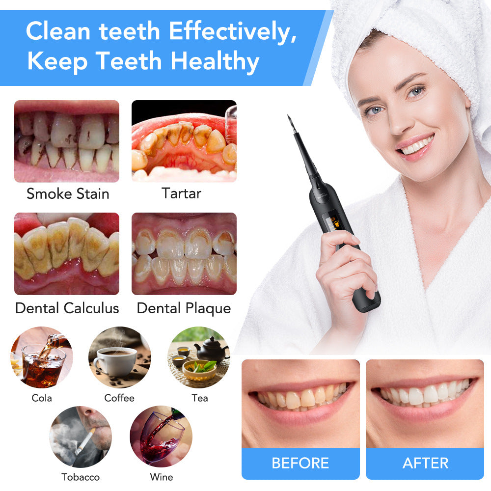 Smart Electric Dental Cleaner — Tartar, Calculus & Whitening Tool